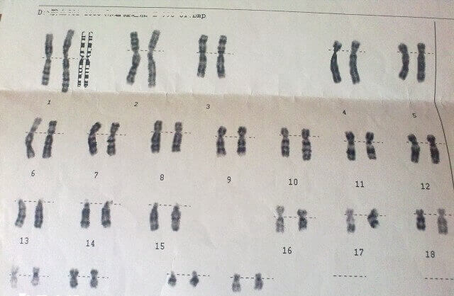 1至22号染色体都代表着什么