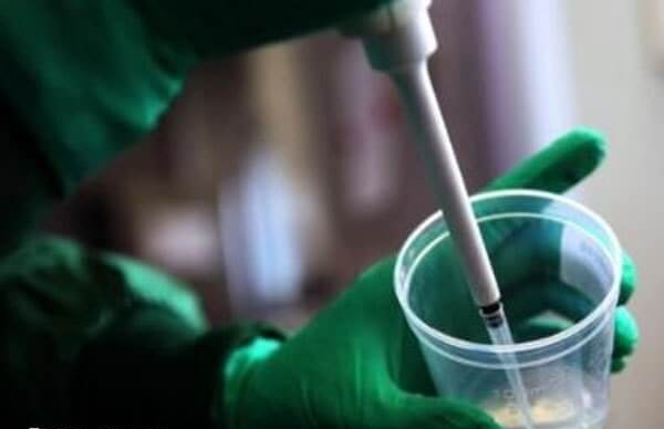 泰国能不能HIV洗精做试管婴儿