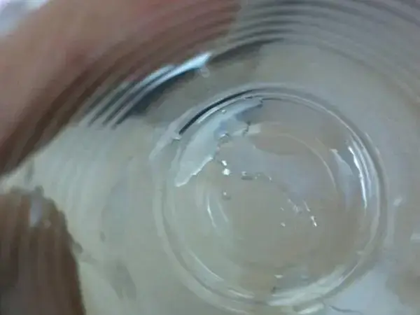 男性hiv做试管会不会感染女方