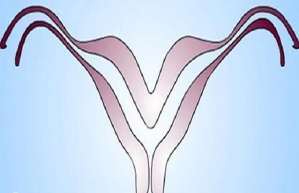 幼稚子宫的治疗方法有哪些