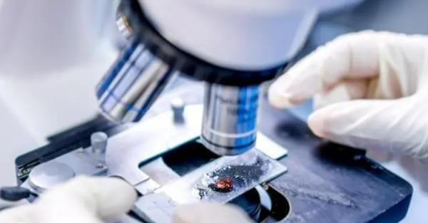 试管婴儿HIV感染成功的例子有哪些