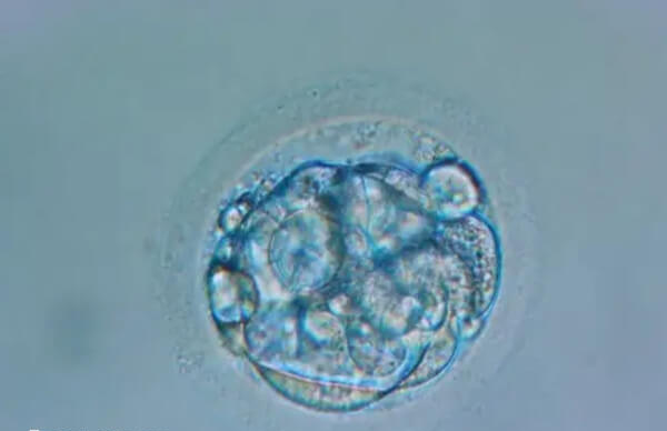 移植后胚胎质量不好是什么原因