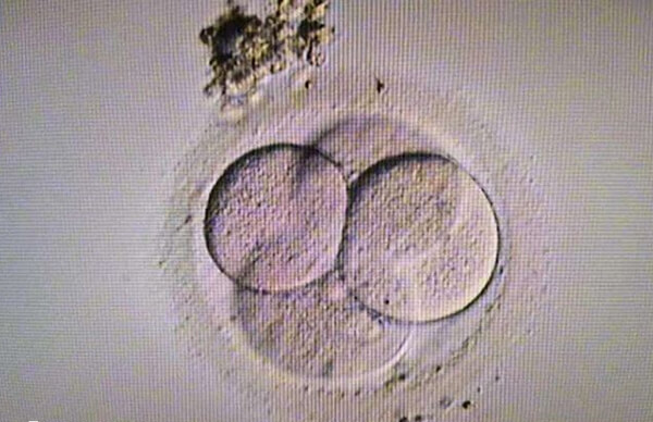 更年期做试管婴儿要怎么调理 更年期做试管婴儿要怎么调理