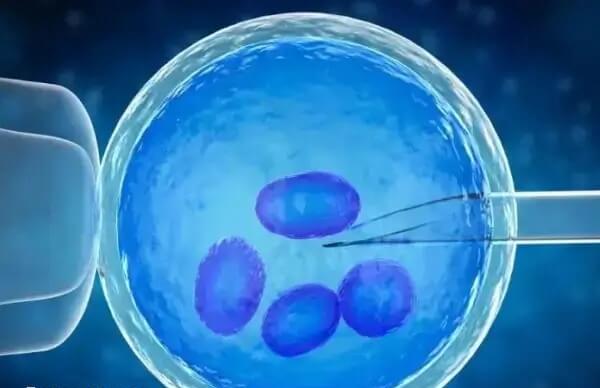 高龄去俄罗斯做试管婴儿如何一次成功