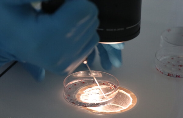 二代试管婴儿比一代贵在哪