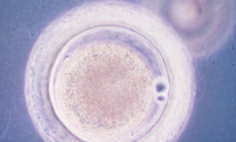 免疫性不孕做试管成功率多少