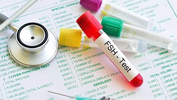 试管移植转氨酶偏高是怎么回事