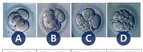 评估胚胎质量的标准是什么