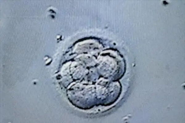 为什么着床成功会怕冷