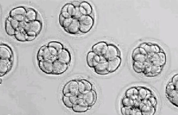 高龄试管一次移植几个