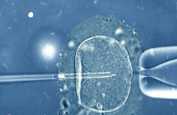 马来西亚第三代试管婴儿多少钱