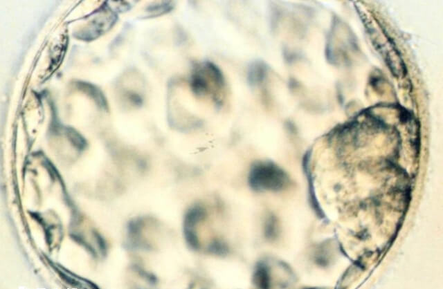 优势卵泡不规则的哪些改善方法