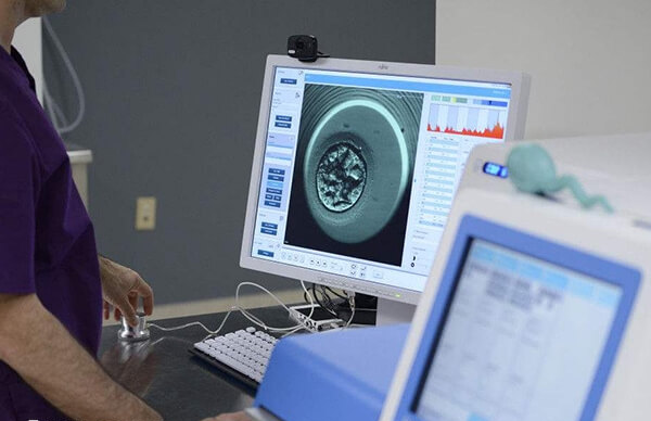 试管养囊成功了4个需要交多少钱