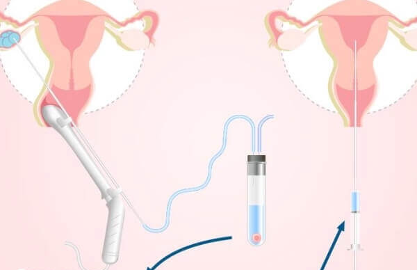 胚胎14c质量怎么样