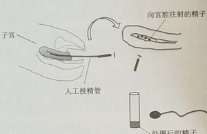 濮阳人工授精多少钱